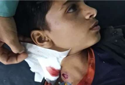 انفجار مقذوف حوثي في 3 أطفال شمال الضالع